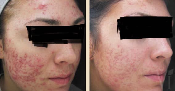 Anew You Aesthetics And Med Spa — photo 1