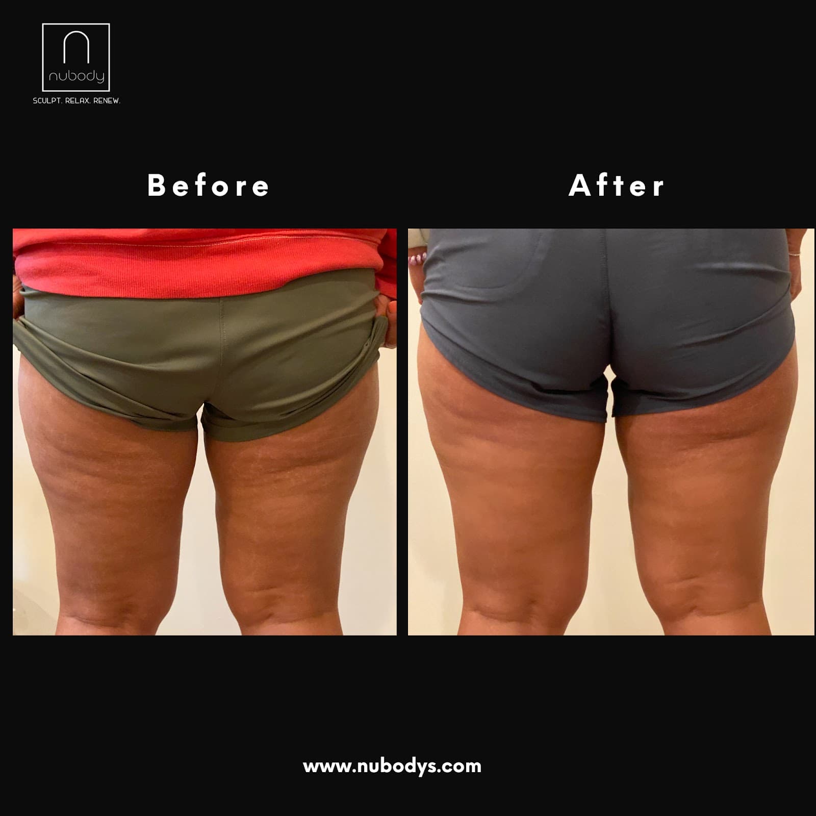 NuBody Spa & Sculpting — photo 1